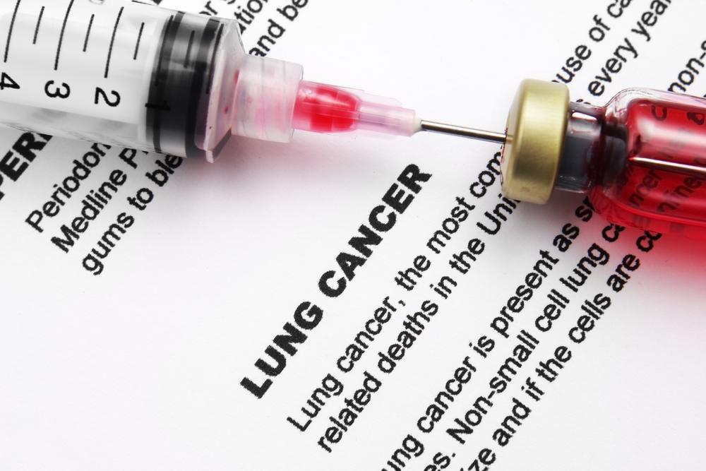 Lung Cancer Treatments for Pleuropulmonary Blastoma