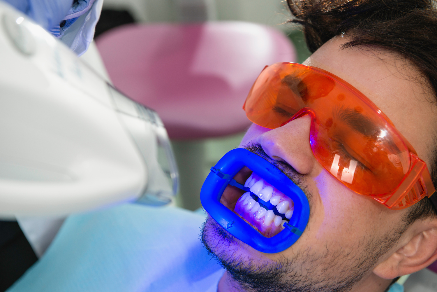 Popular Laser Teeth Whitening Kits