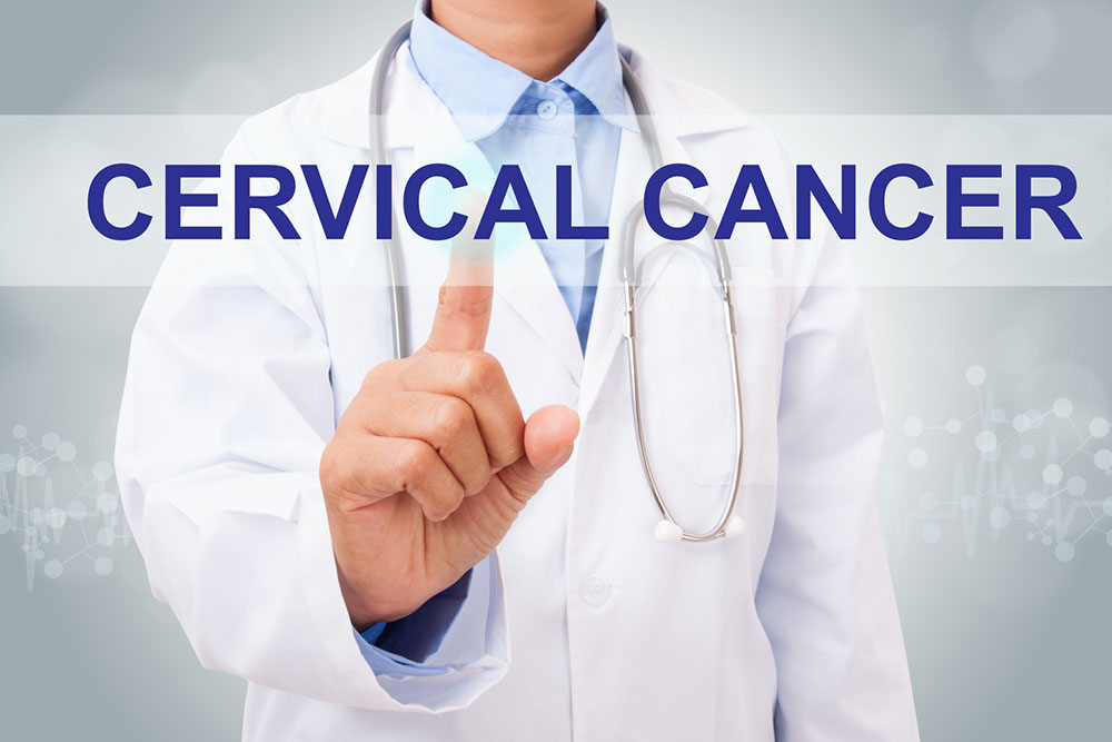 Radiation Therapy for Treating Cervical Cancer