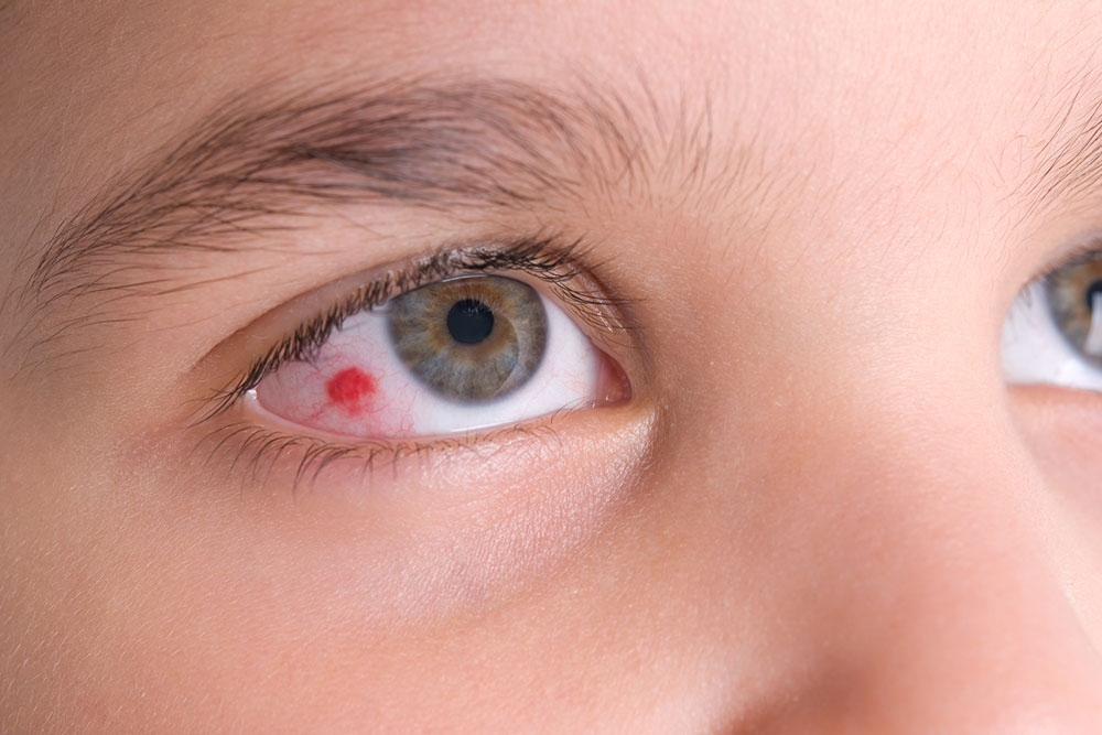 Symptoms, types, and causes of eye infections