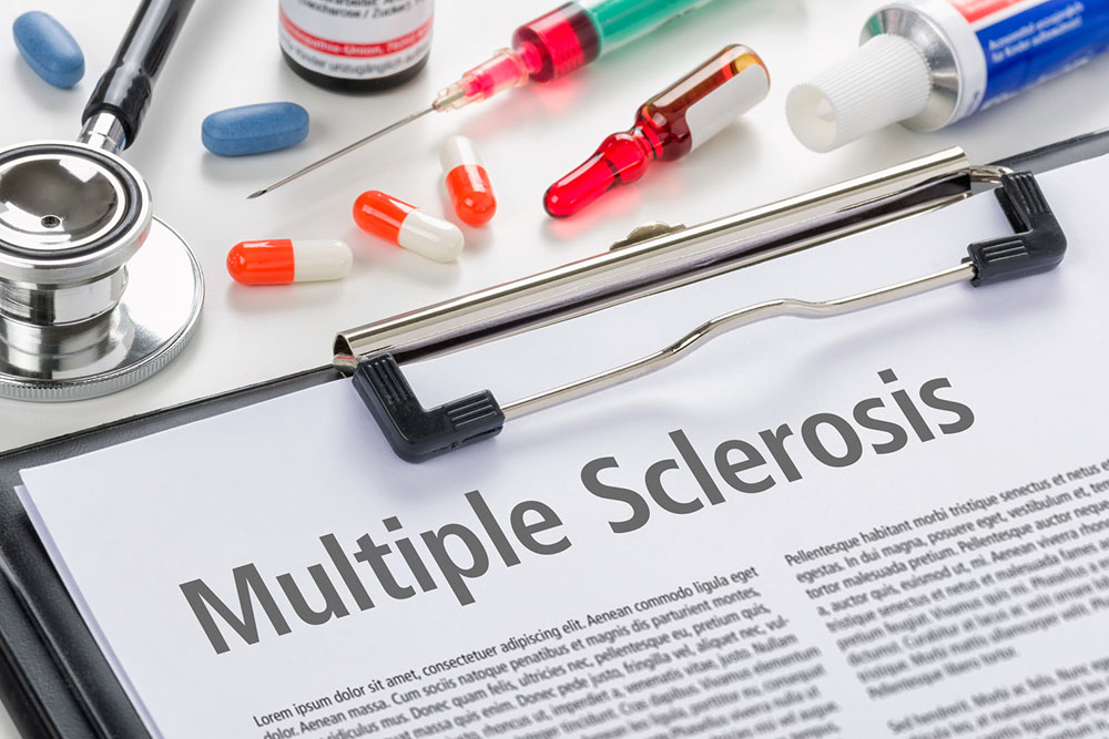 Treating Multiple Sclerosis to Halt Progression