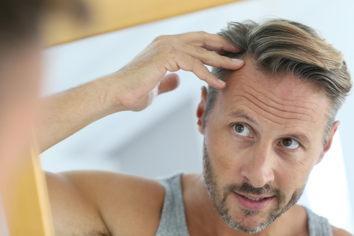 Treatments for Hair Loss in Men
