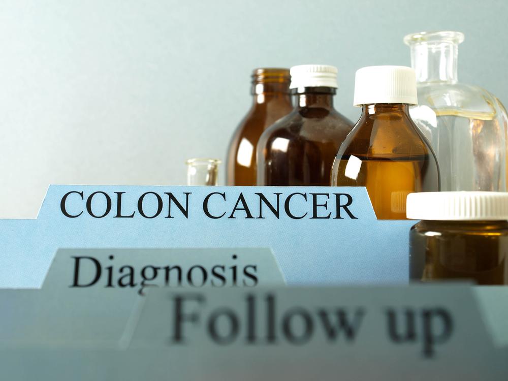 Stages of Colon Cancer: Diagnosis and Treatment