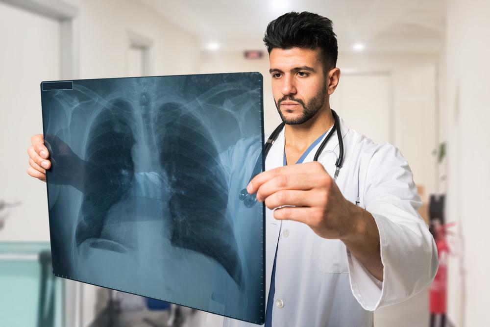 Non-Small Cell Lung Cancer: Types, Causes, and Treatments